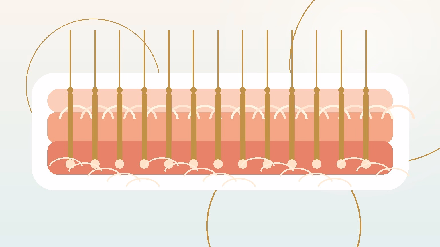 Educational illustration of fractional CO2 laser microzones in the skin