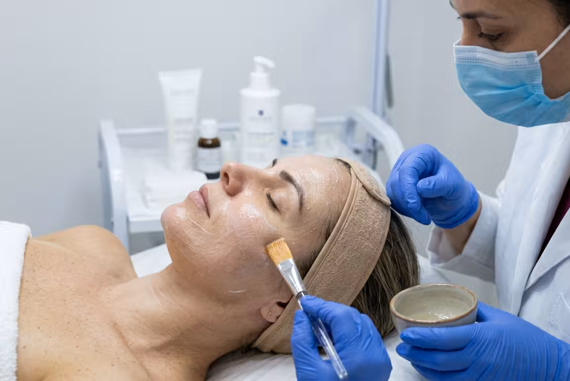 Classificação de Peelings Médicos